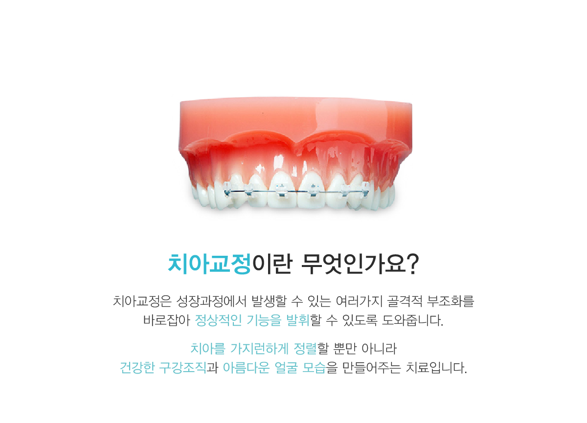 타임치과 치아교정